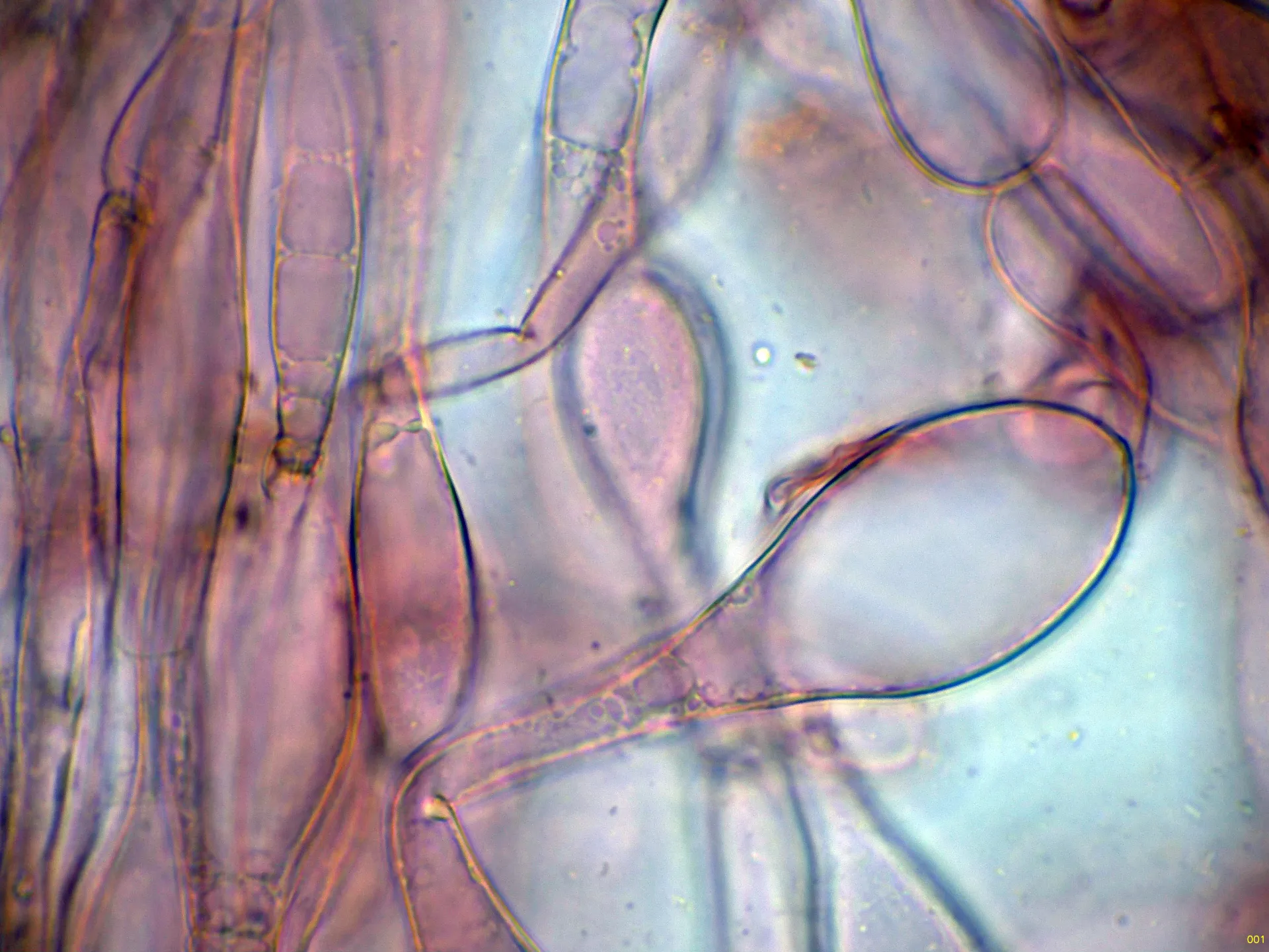 Microscopía de Naucoria scolecina - 10 - Caulocistidios-001